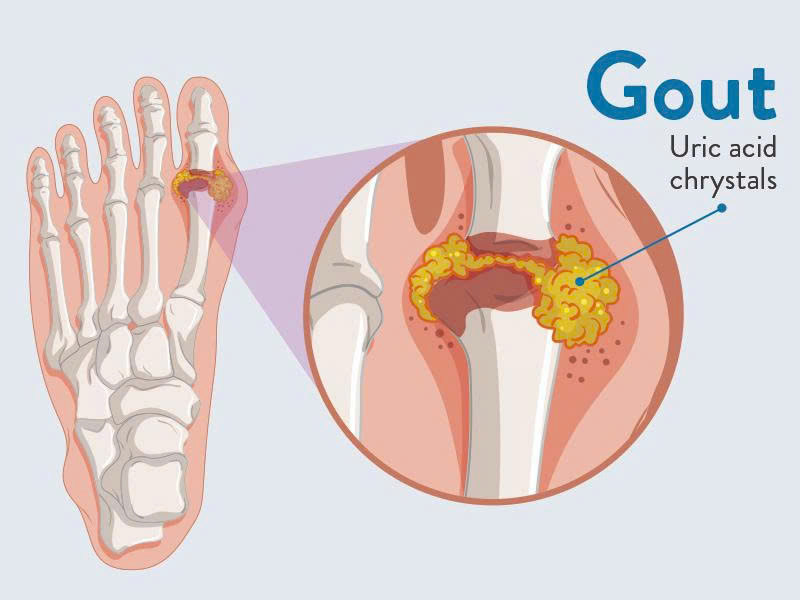 505c5eaff1377c692526